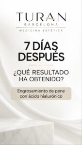 7 días después de un engrosamiento de pene con ácido hialurónico